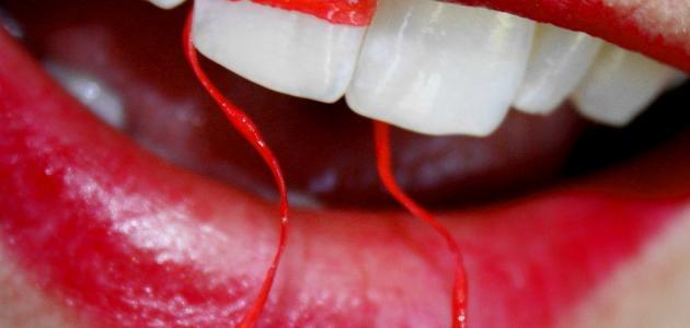 طريقة سريعة لتبيض الاسنان