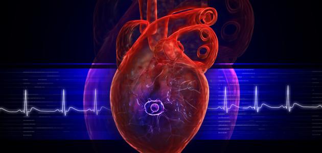 ما هو تضخم عضلة القلب