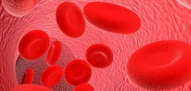 ما هي أسباب نقص الحديد في الدم