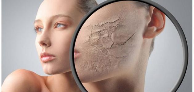 كيفية علاج بشرة الوجه