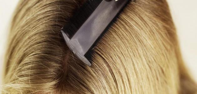 كيف تقضي على القمل في الشعر