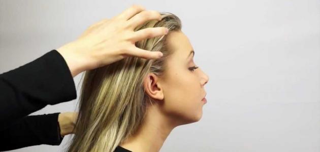 طريقة التخلص من القشرة في الشعر
