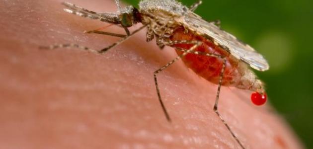 ما هي عوارض الملاريا