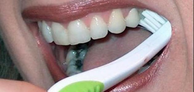 طريقة التخلص من تسوس الأسنان في المنزل