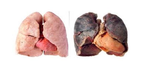 كيف يتم تنظيف الرئة من آثار التدخين