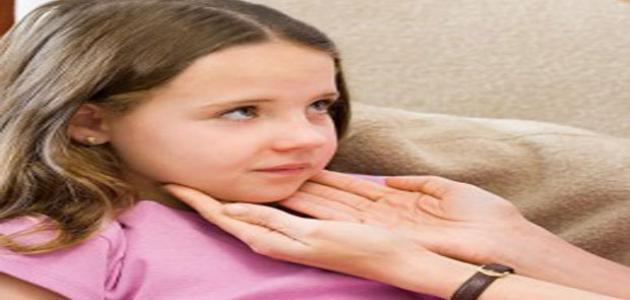 ما علاج التهاب اللوز عند الأطفال