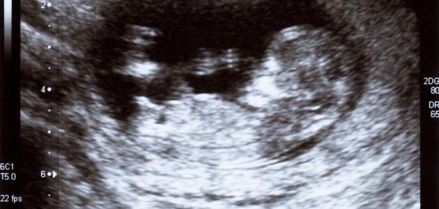 علامات ظهور الحمل في الأسبوع الأول