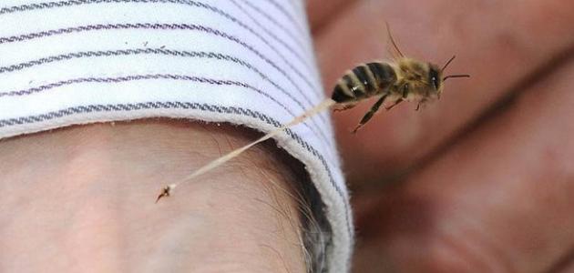 كيف تعالج لسعة النحل