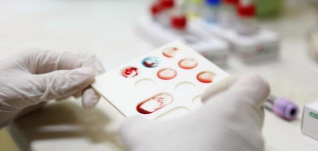 طريقة معرفة فصيلة الدم