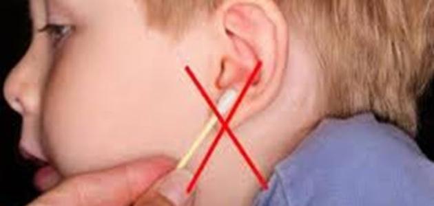 ما هي أعراض ثقب طبلة الأذن