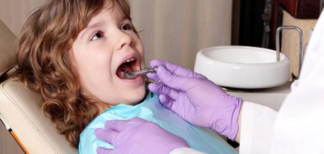 أسباب تسوس الأسنان عند الأطفال
