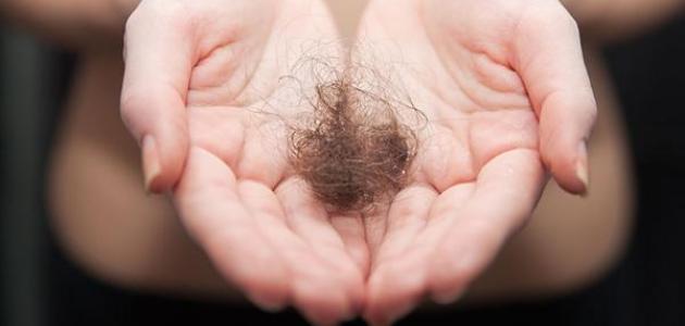 طرق علاج تساقط الشعر عند النساء