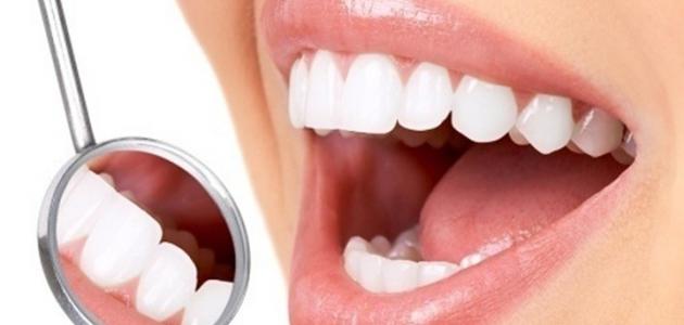 علاج جير الأسنان بالأعشاب