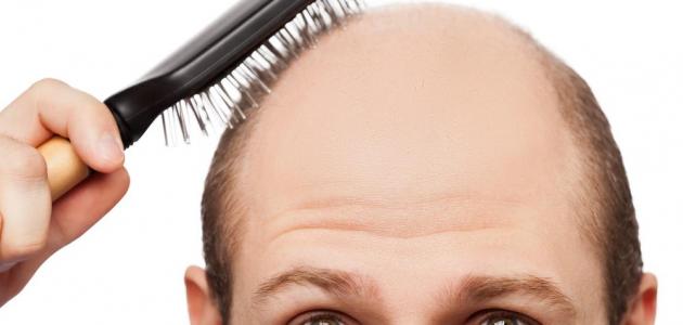كيفية علاج تساقط الشعر عند النساء