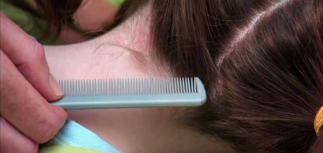 كيف يظهر القمل في الشعر