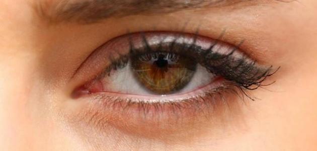 كيفية إزالة الهالات السوداء تحت العين