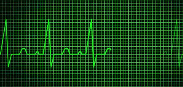 ما هو علاج ضربات القلب السريعة