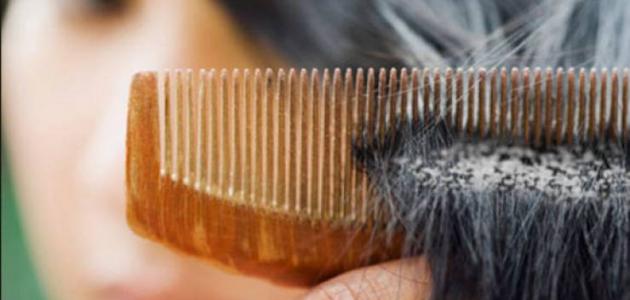كيفية إزالة القشرة من الشعر نهائياً