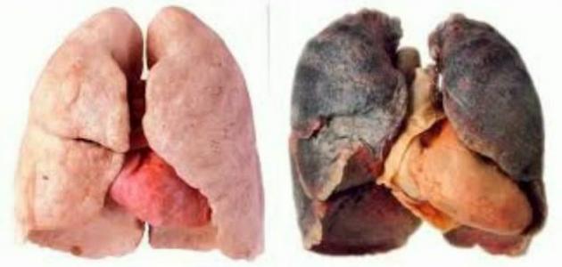 أضرار التدخين على صحة الجسم