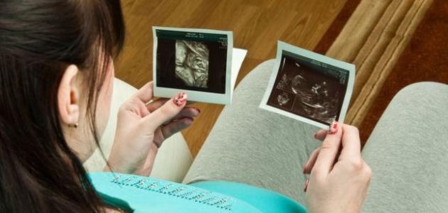 في أي أسبوع من الحمل ينزل رأس الجنين في الحوض
