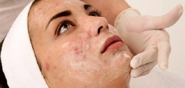 كيفية علاج بقع الوجه