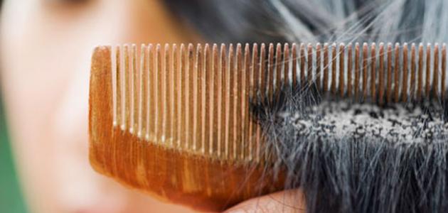 كيف تتخلص من قشرة الشعر