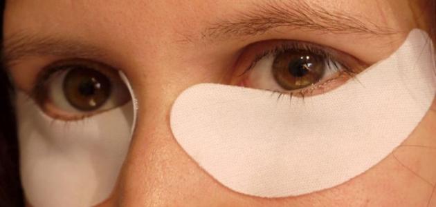 كيفية إزالة الانتفاخ تحت العين