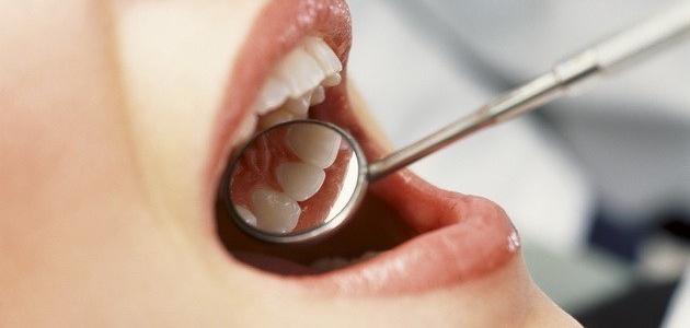 طرق علاج خراج الأسنان