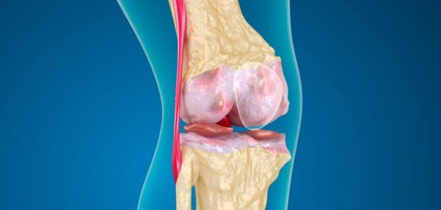 كيفية علاج قطع غضروف الركبة