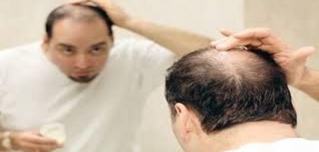 كيف تمنع سقوط الشعر