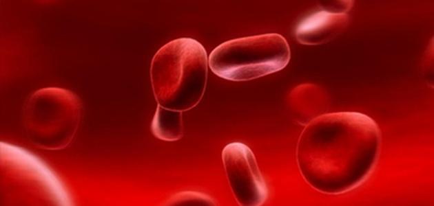 ما سبب فقر الدم في الجسم