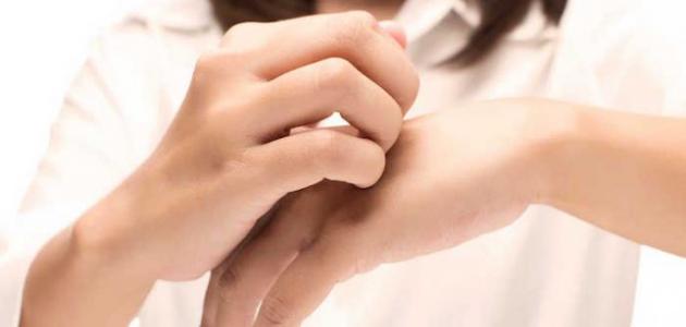 علاج جفاف جلد اليد