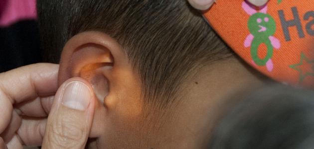طرق علاج طنين الأذن