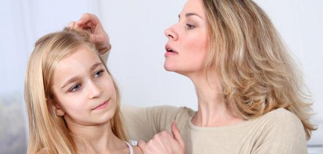 كيفية حماية الشعر من القمل
