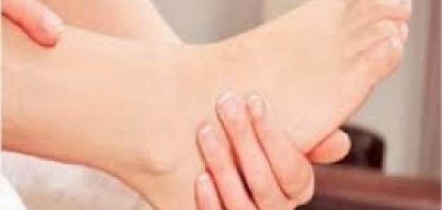 علاج شوكة القدم