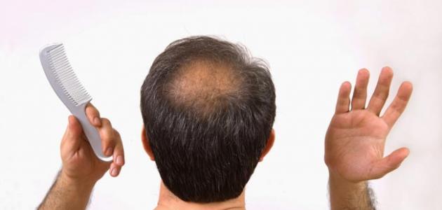 أسباب تساقط الشعر عند الرجال - حروف عربي