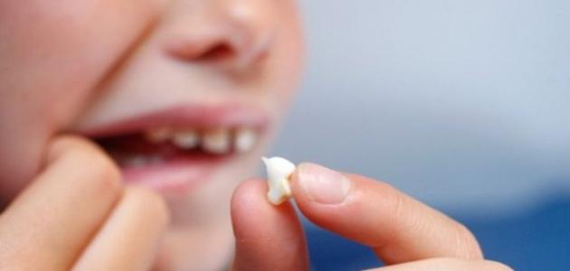 فقدان الأسنان الدائمة عند الأطفال - فيديو