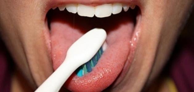كيفية علاج فطريات الفم