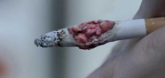أضرار التدخين على الجسم