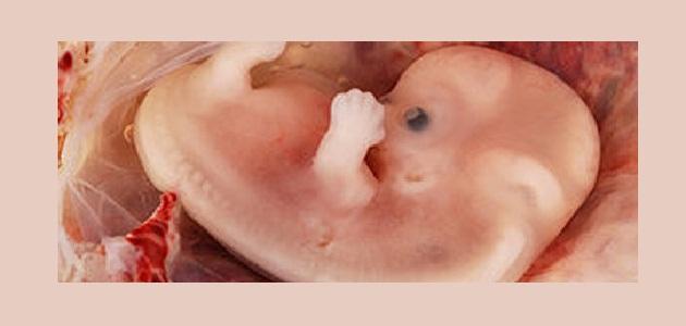 ما هي أسباب عدم اكتمال نمو الجنين