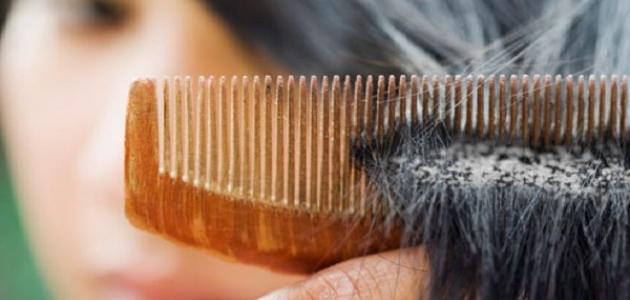 طرق معالجة قشرة الشعر