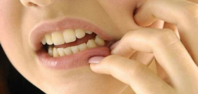 كيف أوقف ألم الأسنان