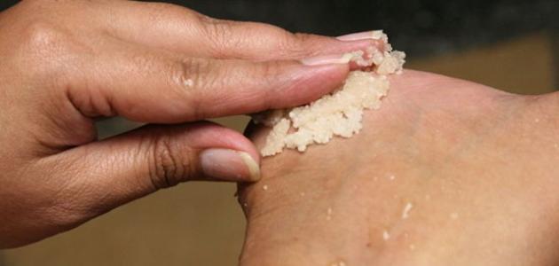 علاج فطريات القدم بالثوم