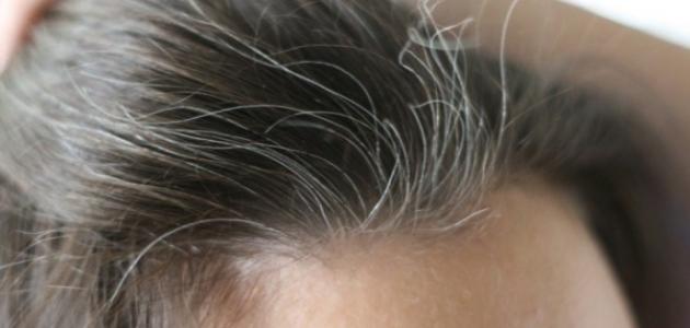 أسباب ظهور الشعر الأبيض في سن مبكر